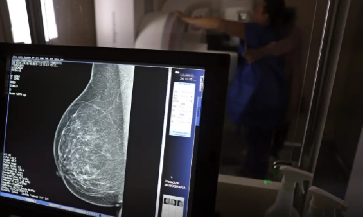 Câncer de mama: uma em cada três pacientes tem menos de 50 anos