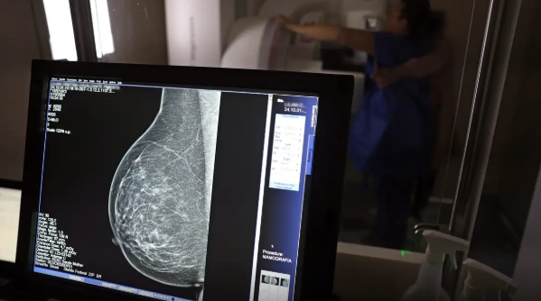 Câncer de mama: uma em cada três pacientes tem menos de 50 anos