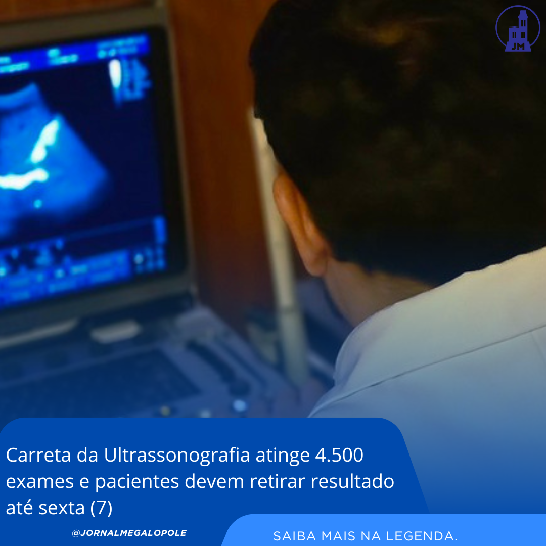 Carreta da Ultrassonografia atinge 4.500 exames e pacientes devem retirar resultado até sexta (7)